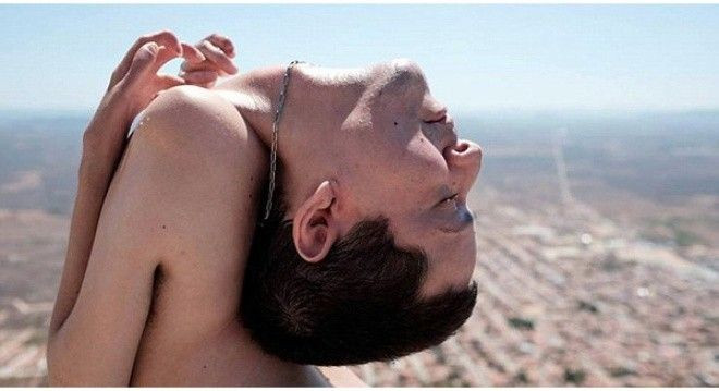 Nghị lực sống phi thường của chàng trai 'đầu lộn ngược' Ảnh 2