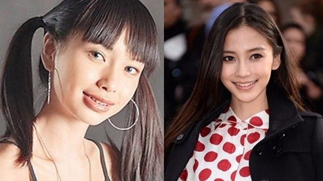 Niềng răng: Không phải cứ đau là sẽ đẹp! Ảnh 2