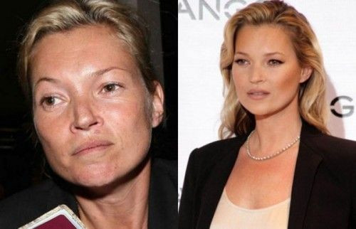 Kate Moss, siêu mẫu lừng danh khi chưa trang điểm liệu bạn có cảm thấy còn ánh hào quang phía sau nữa hay không