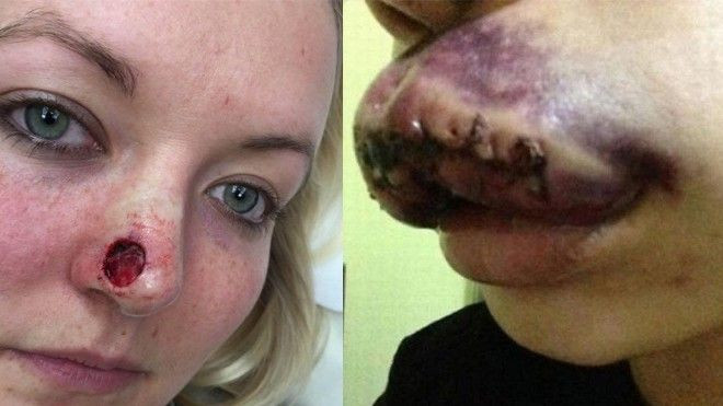 Dám chắc bạn sẽ chẳng bao giờ đi PTTM sau khi xem những bức hình này! Ảnh 2