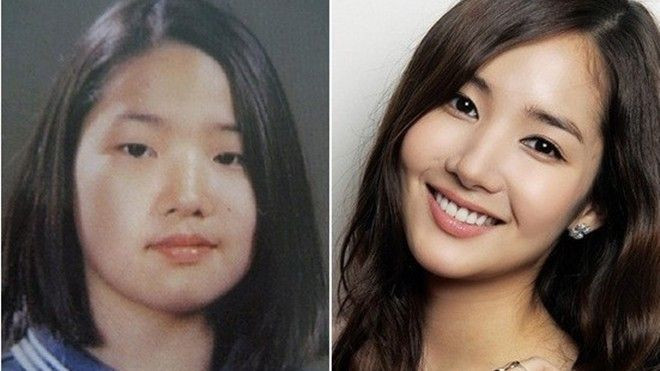 Sao Hàn nghiện dao kéo bộ phận nào nhất trên cơ thể? Ảnh 2