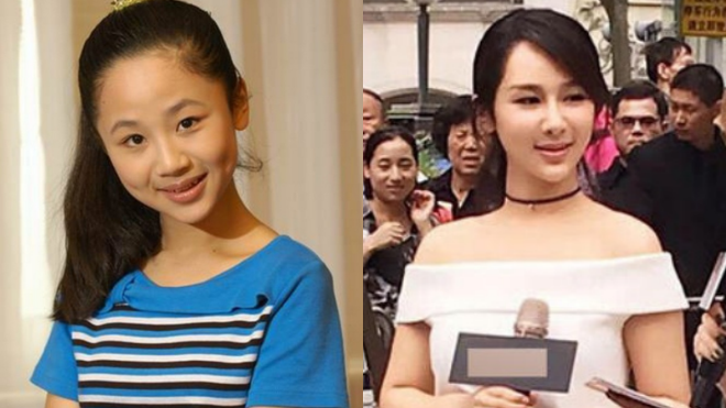 'Tiểu tiên nữ' Hoa ngữ gây sốc vì gương mặt cứng đờ như tượng sáp Ảnh 2