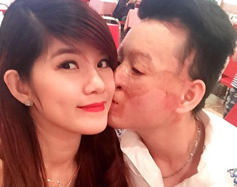 Cặp đôi 'chồng xấu - vợ xinh' sau 2 năm kết hôn giờ ra sao? Ảnh 2