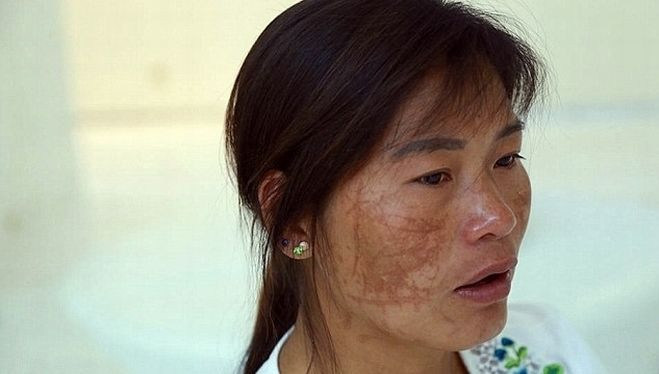 Gã chồng bất lương cùng nhân tình rạch nát mặt vợ Ảnh 2