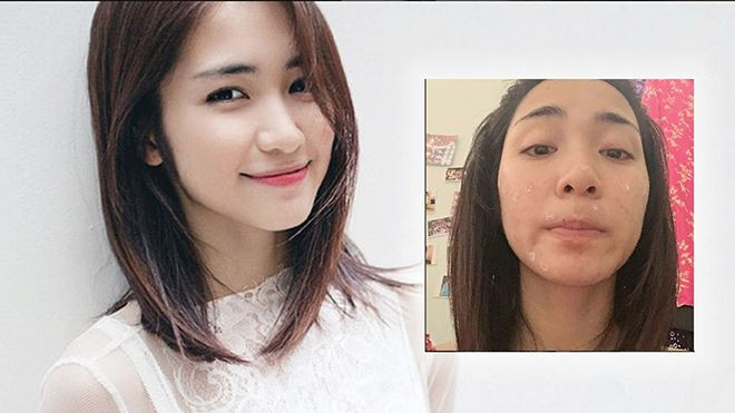 Hòa Minzy: ‘Mụn đầy mặt, có những lúc tôi làm bạn với khẩu trang 20/24h’ Ảnh 2