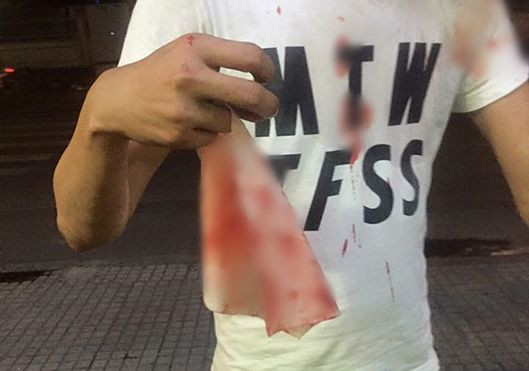 Để vé xe dính nước mắm, khách bị nhân viên quán bánh cuốn đánh hộc máu mũi Ảnh 2