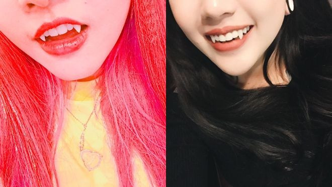 Độ răng nanh: Lại một trào lưu làm đẹp 'thách thức giới hạn' Ảnh 2