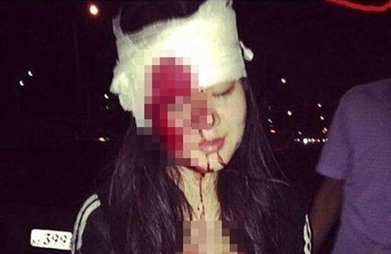 Mỹ nữ chụp ảnh làm màu trên xế hộp với bạn trai và cái kết kinh hoàng Ảnh 2