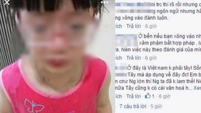 Sốc: Cô giáo người Mỹ hất bát mắm tôm vào bé gái 5 tuổi Ảnh 2