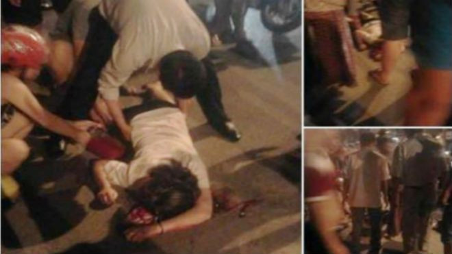 Bị giật túi xách trên đường Hà Nội, cô gái trẻ phải khâu chục mũi ở đầu Ảnh 2