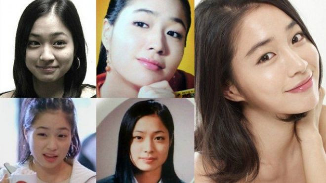 Những nghệ sĩ là bằng chứng cho thấy 'đẹp nhân tạo hơn xấu tự nhiên' Ảnh 2