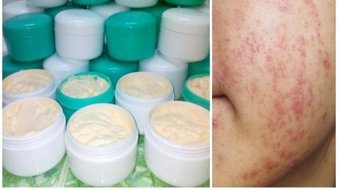 Các cô gái, đừng chần chừ nữa, hãy chia tay với kem trộn ngay từ hôm nay! Ảnh 2