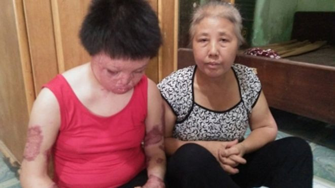 Giây phút khủng khiếp người vợ trẻ đẹp bị chồng tẩm xăng thiêu sống Ảnh 2