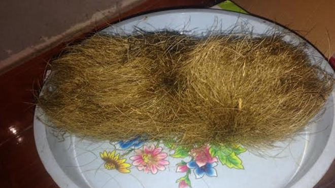 Vĩnh Phúc: Mổ lợn thấy 'trứng vàng' nghi cát lợn tiền tỷ Ảnh 2