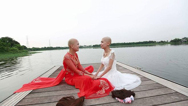 Bộ ảnh của bệnh nhân ung thư khiến vạn người ứa nước mắt Ảnh 2