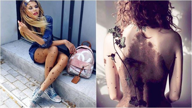 Cô gái với nốt ruồi phủ kín toàn thân trở nên nổi tiếng trên Instagram Ảnh 2