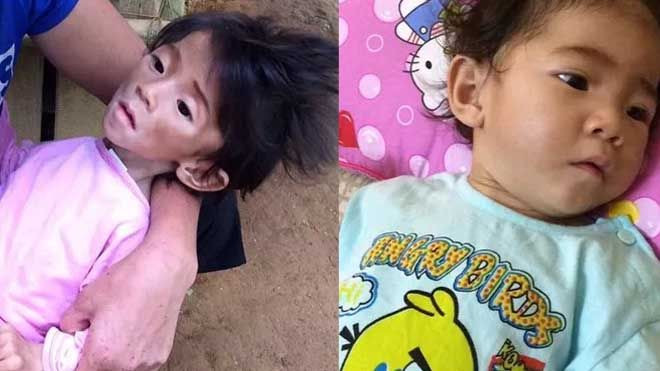 Sau 1 tháng, bé gái 14 tháng từng chỉ nặng 3,5kg đã được 'hồi sinh' thế này… Ảnh 2