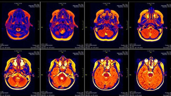 Một lỗi phần mềm nhỏ có thể khiến 15 năm công sức nghiên cứu của các nhà khoa học đổ xuống sông xuống biển Ảnh 2