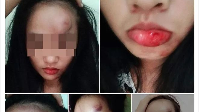 Nàng dâu trẻ bị bố chồng 'đạp vào mặt' chỉ vì một câu nói Ảnh 2