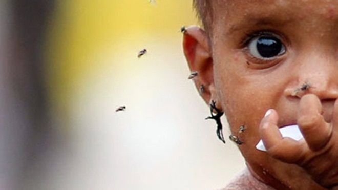 Bật khóc với câu chuyện sau bức ảnh em bé bị ruồi bu gây ám ảnh Ảnh 2