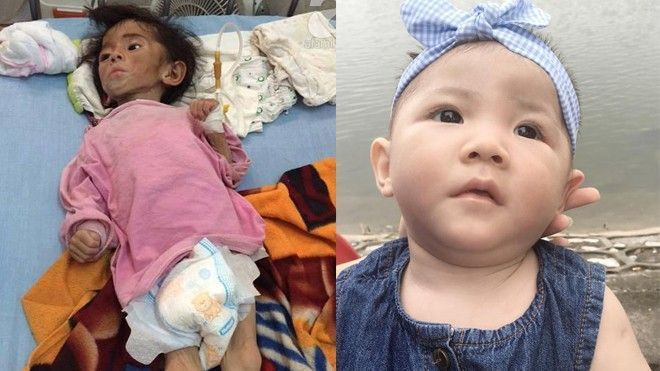 Không còn nhận ra thiên thần xinh xắn này chính là đứa bé bị bỏ đói ở Lào Cai tháng trước! Ảnh 2