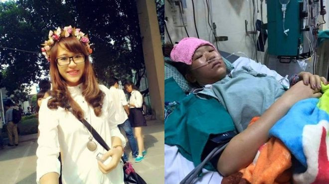 Nữ sinh xinh đẹp hôn mê sâu sau 3 ngày sốt cao Ảnh 2