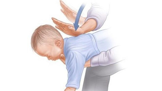 Cách sơ cứu đơn giản khi trẻ bị hóc dị vật mà không phải bố mẹ nào cũng biết Ảnh 2
