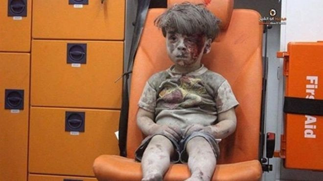 Cả thế giới thương cảm với hình ảnh máu me của cậu bé Syria 5 tuổi Ảnh 2