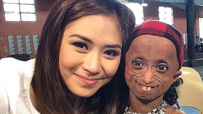 Cuộc đời phi thường của cô gái 19 tuổi mang vẻ ngoài của bà lão 80 Ảnh 2