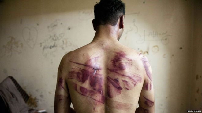Lời kể kinh hoàng của những người bước ra từ nhà tù Syria Ảnh 2