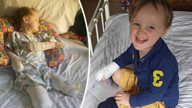 Xót xa bé trai bị cưa chân và tay vì bác sỹ chẩn đoán sai Ảnh 2