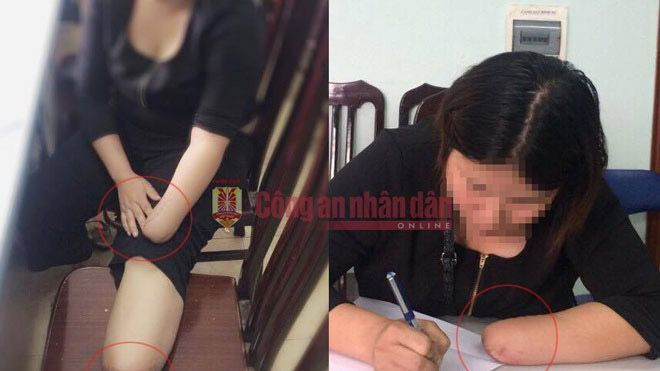 Hãi hùng lời thú nhận thuê chặt chân tay để trục lợi của cô gái trẻ Ảnh 2