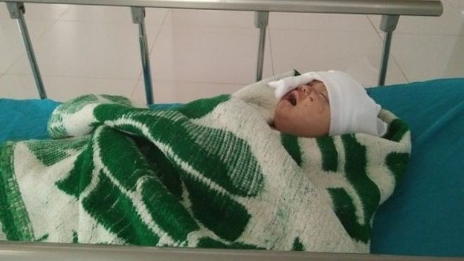 Bé 4 tháng tuổi sống sót kỳ diệu sau tai nạn lật xe ở Quảng Bình Ảnh 2