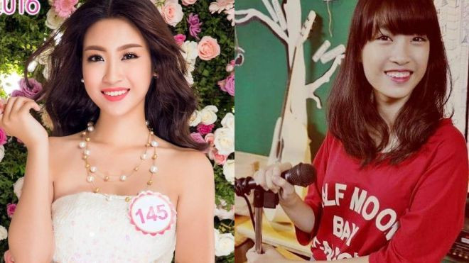 Vừa đăng quang, Tân Hoa hậu Việt nam 2016 vướng ngay nghi vấn làm răng Ảnh 2