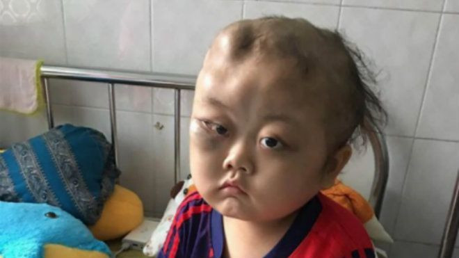 Xúc động trước quyết định của gia đình có con mắc bệnh hiểm nghèo Ảnh 2