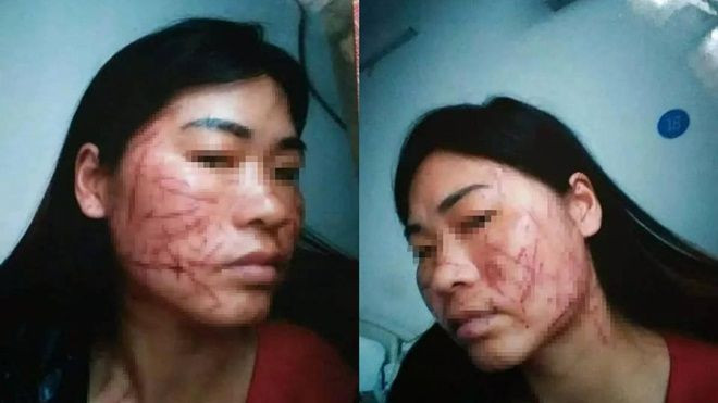 Cái kết của chồng và bồ nhí trong vụ đánh ghen ngược khiến người vợ bị rạch 100 nhát dao vào mặt Ảnh 2