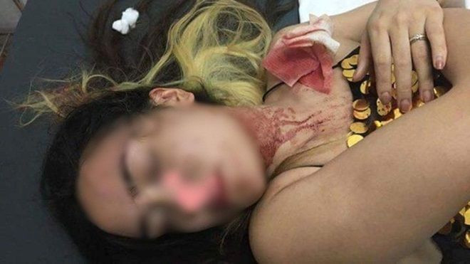 Hà Nội: Cô gái mang bầu 2 tháng tố bị nhân viên quán bar Q-Club đánh nhập viện Ảnh 2