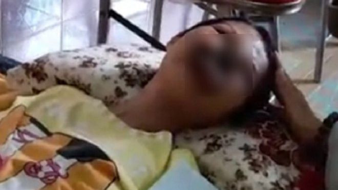 Cô gái ở Đồng Nai mắc bệnh lạ, khuôn mặt bị ăn mòn cả hàm trên và mũi Ảnh 2