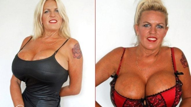 50 tuổi vẫn theo đuổi đam mê ngực khủng Ảnh 2