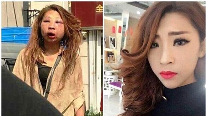 Sau khi bị đánh ghen, đến bố mẹ cũng chẳng nhận ra đây là con gái mình Ảnh 2