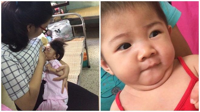 Hình ảnh mới của bé gái 14 tháng tuổi nặng 3,5kg sau hơn 3 tháng được mẹ nuôi chăm sóc Ảnh 2