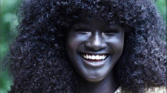 Vẻ đẹp của cô gái có làn da đen kỳ lạ nhất thế giới Ảnh 2