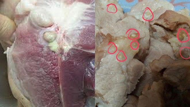 Sán 'chọc' thủng mắt, 'đâm' vào tim: Đây là hậu quả kinh hoàng của thói quen ăn 'vô tội vạ' Ảnh 2