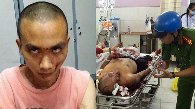 Sư thầy trong vụ chém người ở chùa Bửu Quang có dấu hiệu về thần kinh Ảnh 2