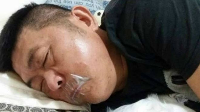 Chồng dán băng dính miệng mình để vợ khỏi nghe tiếng ngáy Ảnh 2