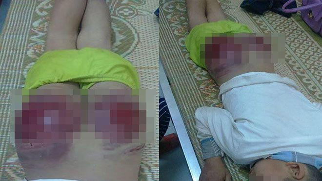 Bố đánh con tứa máu ở Thái Nguyên: 'Tôi cũng thương lắm, nhưng…' Ảnh 2