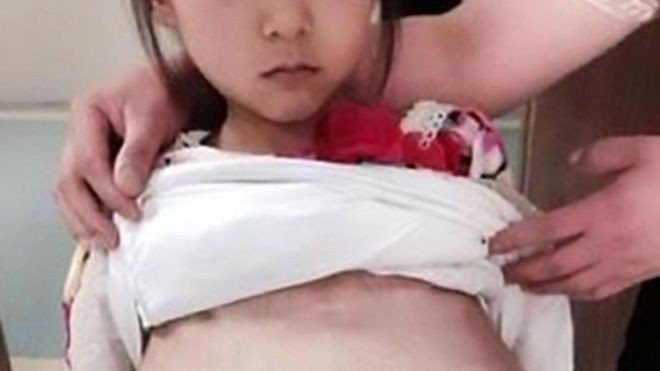 Bé gái Việt 12 tuổi mang thai 3 tháng bị bán làm vợ với giá hơn 100 triệu Ảnh 2