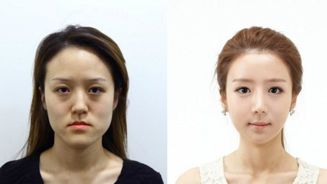 Phẫu thuật thẩm mỹ và đổi đời, đây chính là cặp chị em sinh đôi hot nhất tuần này! Ảnh 2