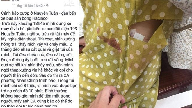 Hà Nội: Cô gái trẻ bị 2 tên cướp táo tợn cướp túi xách và làm rách hông bằng vật sắc nhọn Ảnh 2