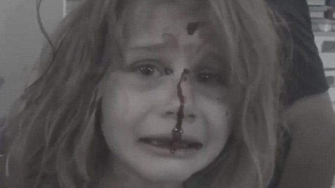 Bé gái Syria kêu khóc gọi cha với khuôn mặt đầy máu sau vụ nổ bom Ảnh 2